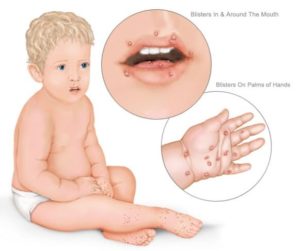 06e08456cae95b8f473a5fceb1446e36