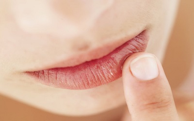 como curar labios resecos