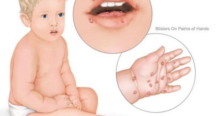 06e08456cae95b8f473a5fceb1446e36