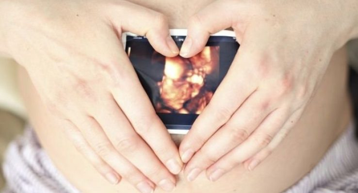 185b6a8b85153b8bf20d2133e622ee4c