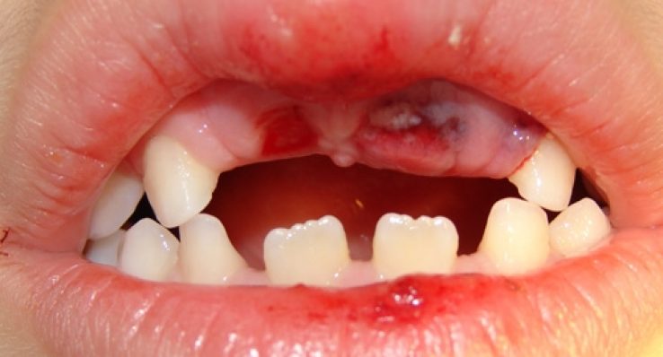 25c1574e8e6a7de12f717ac56a926ad5 25c1574e8e6a7de12f717ac56a926ad5