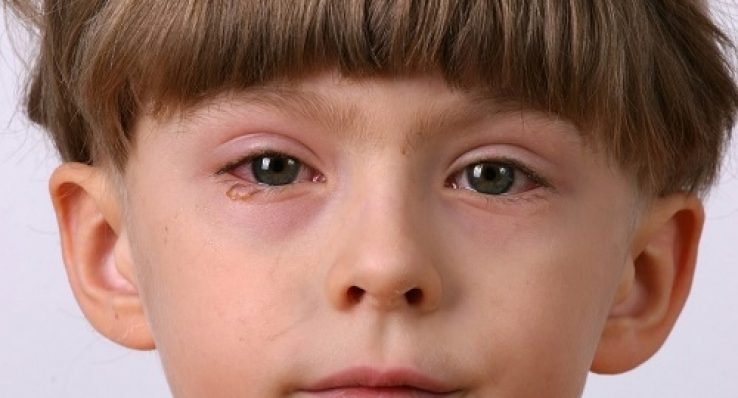 6bfebd1c3ab25d1cf8939c071f7a71e9