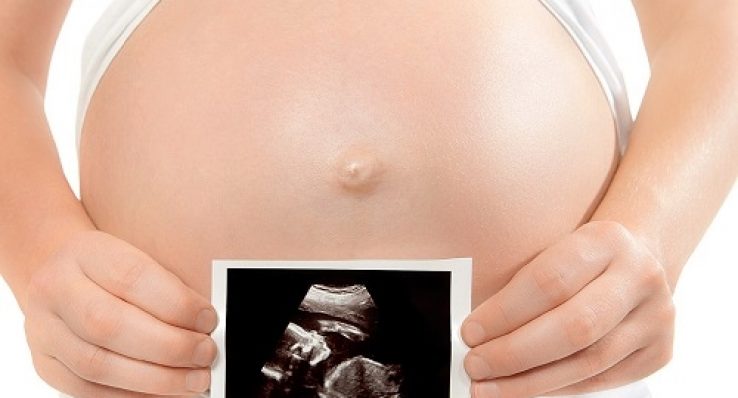 83d805430a76a62d95bd944b328ed4da