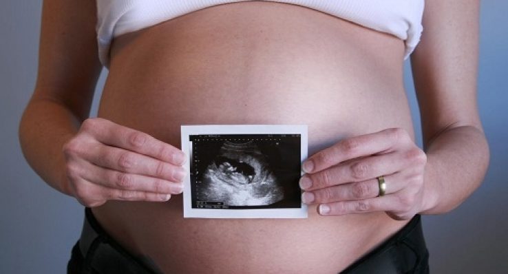 9a34ce5041dde96a038887b0f6ca28bc