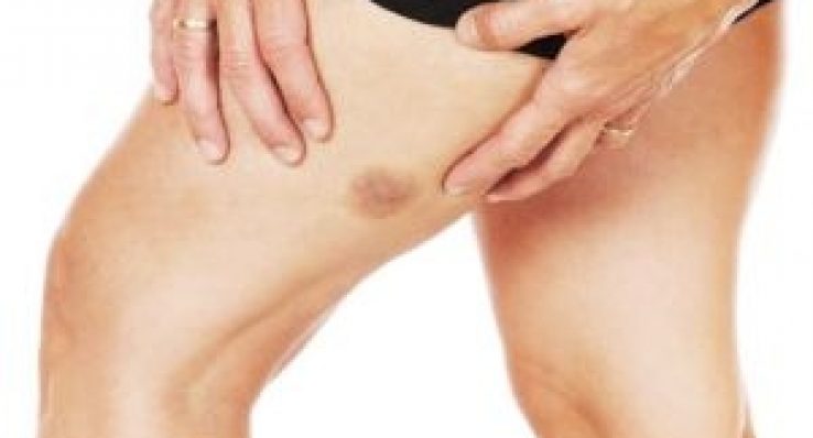 ee68a9df1200997b07be8fb0bbdb9f29